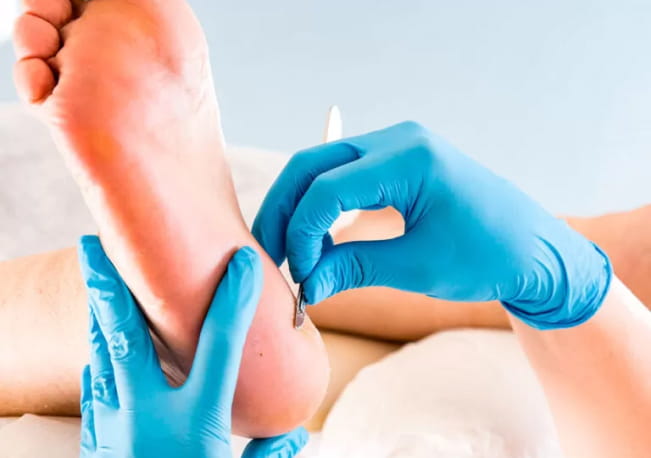 Подологічний педикюр спортсменам у Києві | Медичний догляд стоп Podo-Terra 3