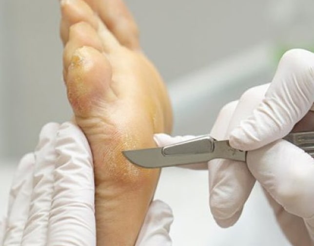 Подологічний педикюр для літніх людей Київ — безпечний медичний догляд і доступна ціна в Podo-Terra 1