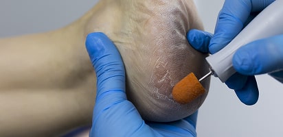 Подологічний педикюр для літніх людей Київ — безпечний медичний догляд і доступна ціна в Podo-Terra 4