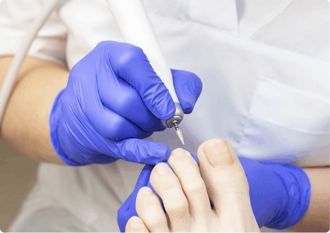 Подологічний педикюр спортсменам у Києві | Медичний догляд стоп Podo-Terra 8