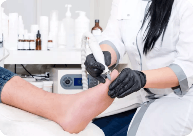 Подологічний педикюр спортсменам у Києві | Медичний догляд стоп Podo-Terra 10