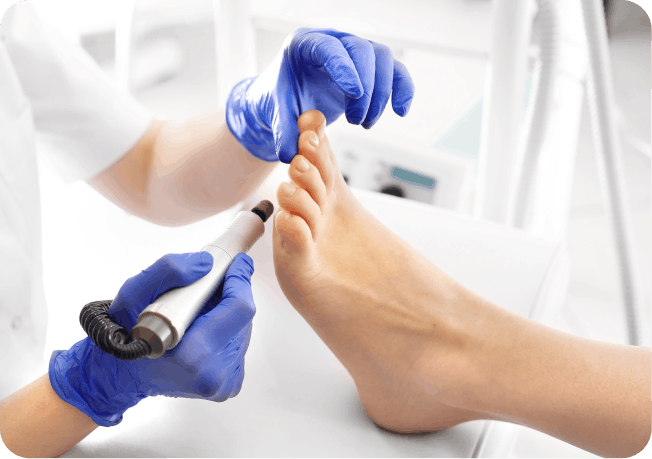 Подологічний педикюр спортсменам у Києві | Медичний догляд стоп Podo-Terra 7